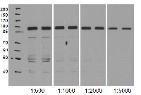NodGS | Nodulin / glutamate-ammonia ligase-like protein in the group Antibodies Plant/Algal  / Nitrogen Metabolism at Agrisera AB (Antibodies for research) (AS15 3030)